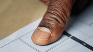 Fixing Mistakes on a Death Certificate